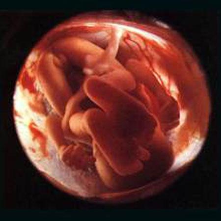 Предложен новый способ диагностики генетических аномалий у эмбрионов