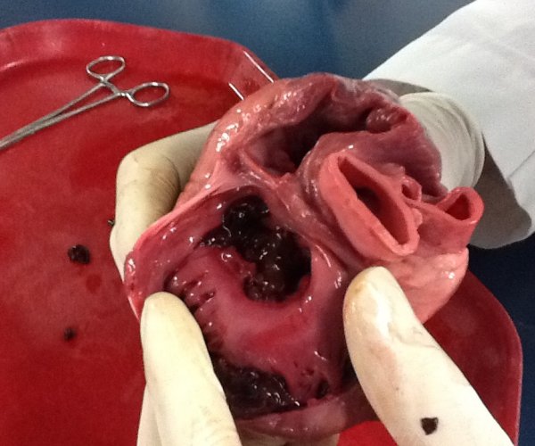 3D-технологии помогут хирургам в лечении сердечно-сосудистых патологий