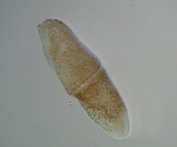 Найден червь - общий предок позвоночных, иглокожих и полухордовых