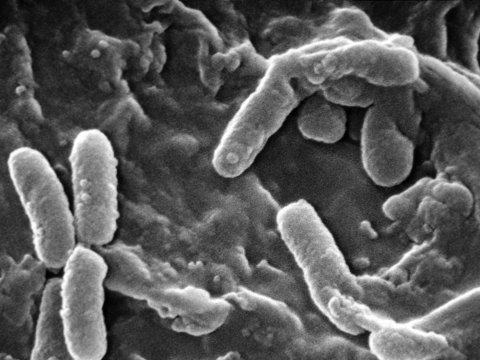 Патогенные бактерии все менее восприимчивы к антибиотикам