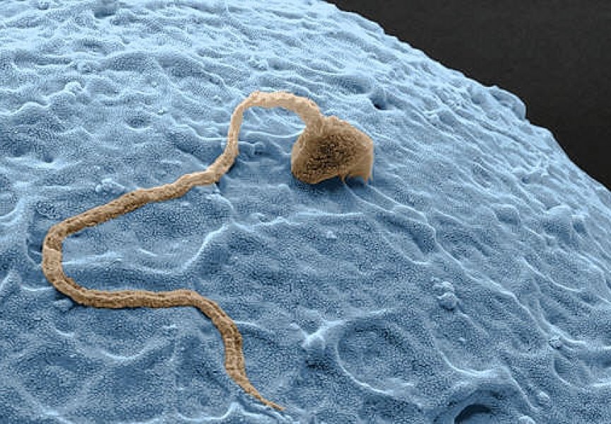 Ученым удалось получить искусственный сперматозоид