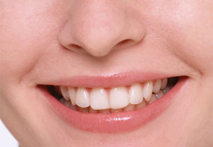 Разработан новый метод лечения зубов