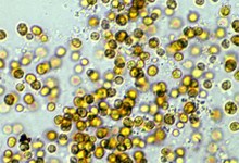 Симбиотические водоросли Symbiodinium kawagutii в культуре под световым микроскопом. Фото Scott R. Santos с сайта gump.auburn.edu