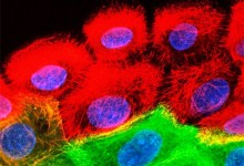 9567-squamous.jpg
