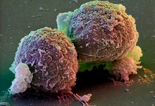 9567-stem_cells.jpg