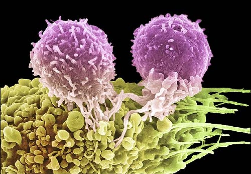 «Революция» в лечении рака уже не за горами