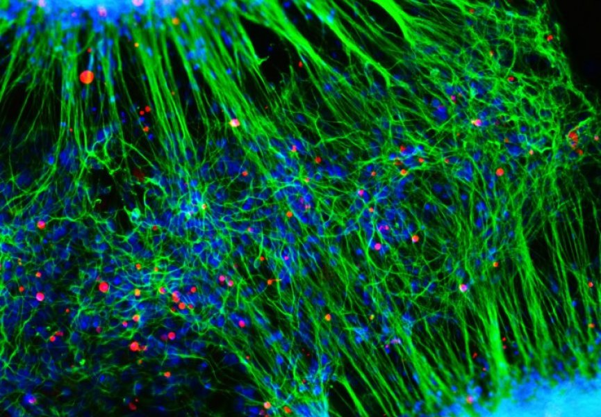 Клетки крови человека превратили в стволовые клетки нервной системы