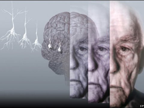 Разработаны новые препараты для лечения болезней Альцгеймера и Паркинсона