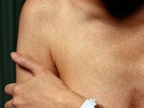 У одиноких женщин выше риск развития онкологии груди