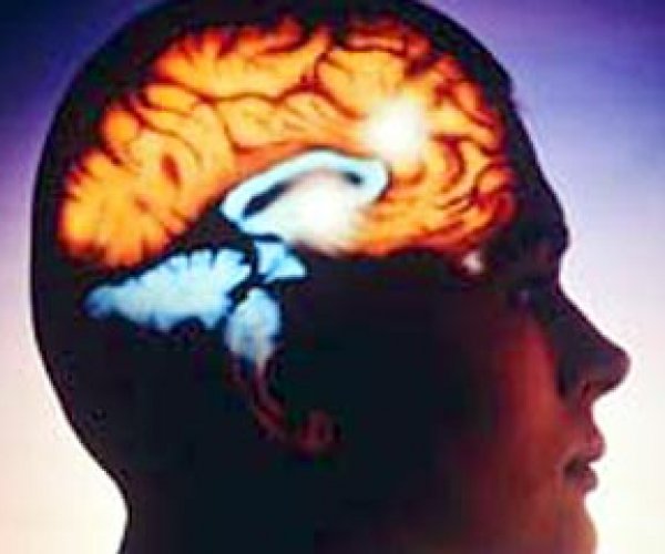 Ухудшение памяти может предвещать инсульт