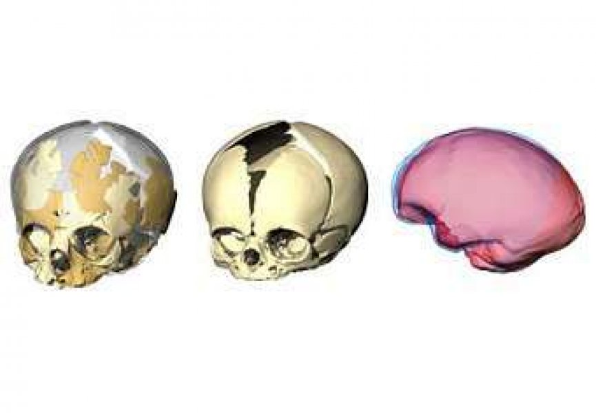 Выявлены отличия в развитии мозга неандертальца и человека разумного