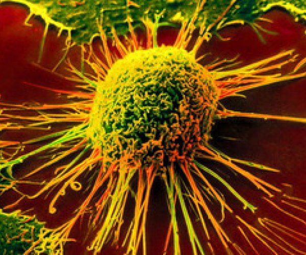Ученые установили, что раковые клетки используют для размножения фруктозу
